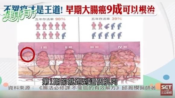 千金難買早「篩」到　腸治久安是王道
