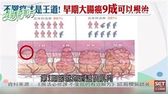 千金難買早「篩」到　腸治久安是王道