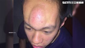 願賭服輸! 彈額頭200下 男竟腫成