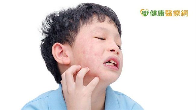 皮膚過敏癢又痛　免疫失衡怎麼辦？