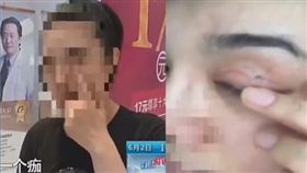 中國,大陸,江蘇,南京,手術,雙眼皮,破洞,傷口(江蘇城市頻道http://tw.weibo.com/xljscity)