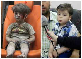  阿勒坡男孩恢復健康（圖／翻攝自臉書Kinana Allouche كنانة علوش） https://www.facebook.com/KinanaAllouchePage/photos/pcb.1382487308455163/1382487278455166/?type=3&theater