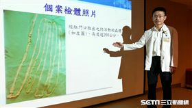 三軍總醫院小兒部醫師何昇遠。（圖／記者楊晴雯攝）