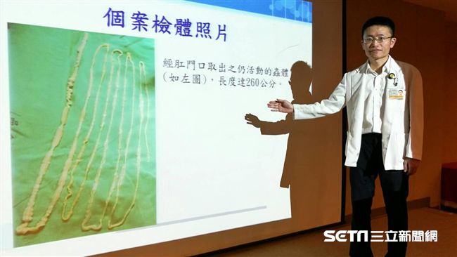 愛吃生魚片～肛門滑出260公分絛蟲