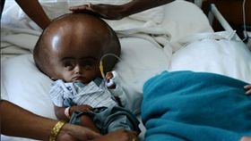 印度,腦部,腦水腫,過世
圖／翻攝自Express News‏ Twitter