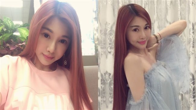 女星扛負債5病纏身　拖4年不敢住院