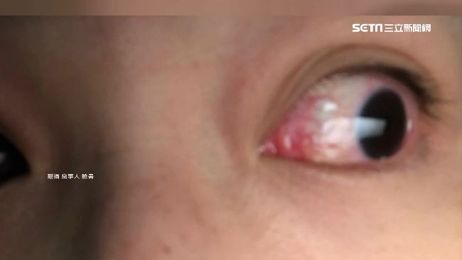 號稱不薰眼卸妝　正妹試用慘變血輪眼