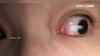 號稱不薰眼卸妝　正妹試用慘變血輪眼