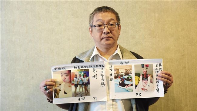 八仙塵爆2年後　重生復健路漫長