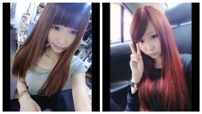 網紅雙腿遭燒殘　聲帶受損仍勇敢追夢