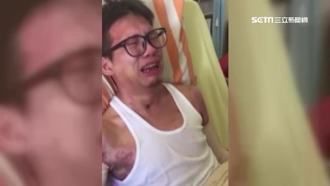 塵爆回頭救2童重傷　他仍與復健奮戰