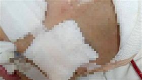 2歲童玩拋接慘摔　頭部重創陷昏迷／翻攝畫面