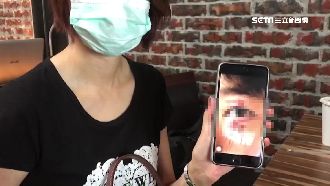 家長控師點名板砸人　害學生眼縫五針