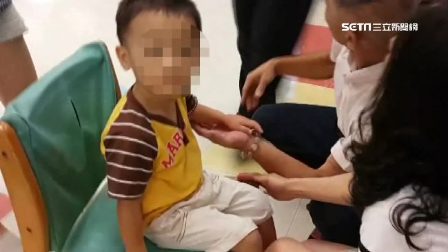 心疼！童嫩手被門夾傷　手腕紅腫送醫