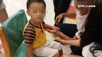 心疼！童嫩手被門夾傷　手腕紅腫送醫