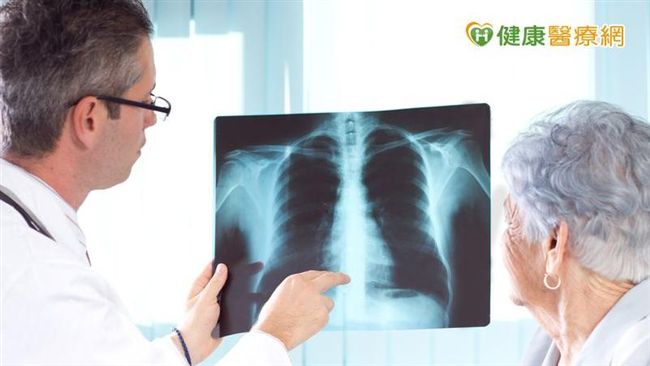 肺癌致死率7年第一！新標靶療效亮眼