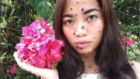 艾薇塔（Evita Patcey Edgar Delmundo）全身長滿了痣與胎記 圖／艾薇塔IG