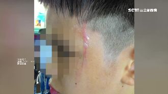 國小兄弟遭霸凌　母怒控校方「河蟹」