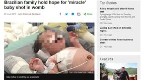 巴西,孕婦,懷孕,嬰兒,胎兒,槍戰,平民窟,奇蹟生還,子彈,子宮,剖腹,半身不遂（圖／翻攝自BBS NEWS）
http://www.bbc.com/news/world-latin-america-40492600