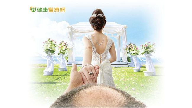 十禿九富？人生勝利組慘遭髮際線KO