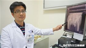 徐自良說，老人跌倒造成的傷害，除了頭部外傷，最常見的就是骨折。（圖／童綜合醫院提供）