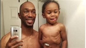 「超級英雄才有管子！」罕病童父這樣做暖哭萬人（圖／翻攝自thelifeofchaceelijah IG）