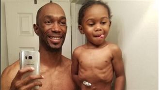 罕病童插胃管　暖爸：超級英雄才有！