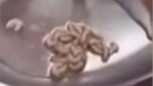 耳朵癢癢der　挖出整坨活蛆狂蠕動