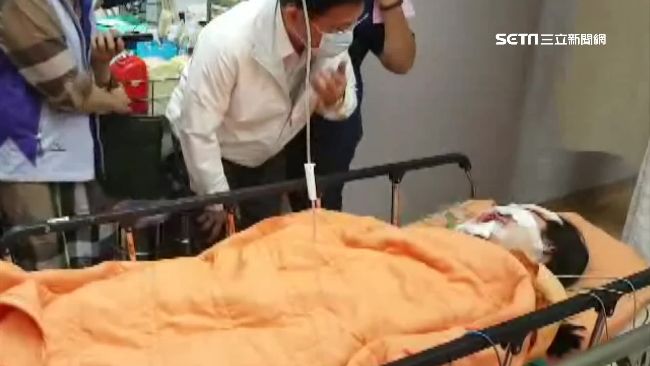 逢甲氣爆臉全毀　樂觀女大生：我沒事