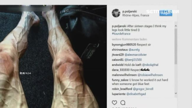 環法車手曬腿照　粉絲嚇壞：樹葉腿！