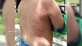 龍潭親水池疑水質髒　童滿身紅疹發癢