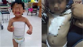  醫生,包紮,傷口,急診,護理師,醫院,爆怨公社,疤痕,人工皮膚,人工皮　圖／翻攝自爆怨公社