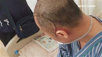 保全勸醫院別抽菸　竟遭打到無法說話