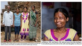 印度,硫酸,酒醉,夫妻
圖／翻攝自每日郵報