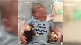 英病童棄醫1600,英國,男嬰,查理,罕見疾病,放棄治療