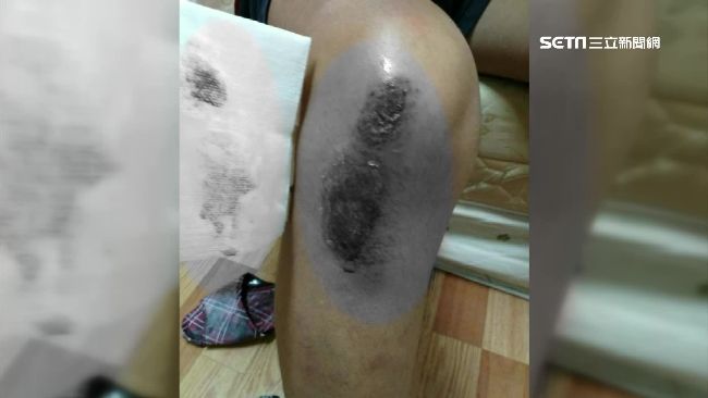 貨車繩索變凶器　女慘遭拖行30米
