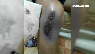 貨車繩索變凶器　女慘遭拖行30米