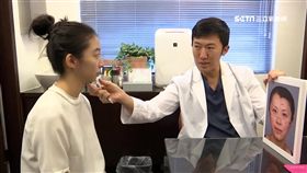 業配,醫美,微整形