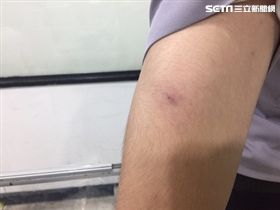 醉失態！女亂認男友不讓走，警排解女誤認是情敵開口咬。