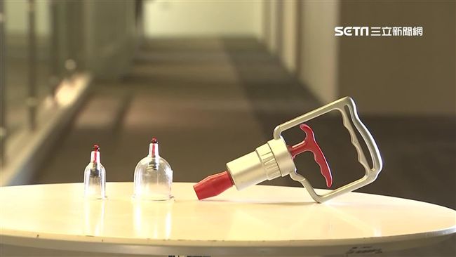 拔罐DIY　醫師：控制不好皮膚壞死