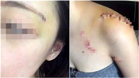  疤痕,傷勢照,診斷證書,通訊紀錄,債務,偷吃,劈腿,動出,過肩摔　圖／翻攝自爆料公社　https://goo.gl/HneKk4