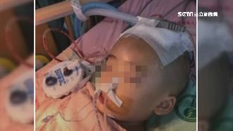 3歲男童疑遭虐　離婚母辯：跌倒撞傷