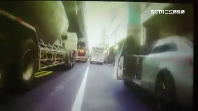 亂開車門害摔　牙醫手骨折恐留後遺症