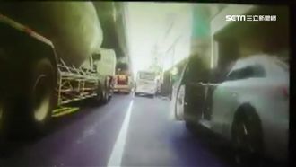 亂開車門害摔　牙醫手骨折恐留後遺症