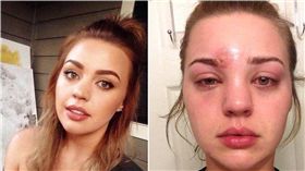 痘痘,青春痘,眉毛,眉刷,Katie Wright　圖／翻攝自臉書