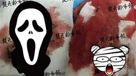 膿包,湖北,武漢,潰爛,蛆蟲,後腦杓,蠕動（圖／翻攝自楚天都市報）