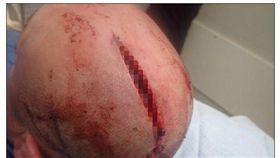 員警處理家暴…被狂怒澳洲人夫「武士刀」砍頭　腦袋被剖開(圖/翻攝自每日郵報)