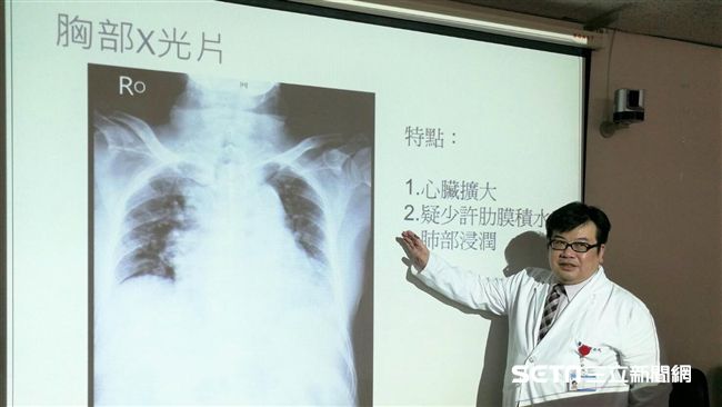 酷暑也別輕忽！9旬翁染流感險送命