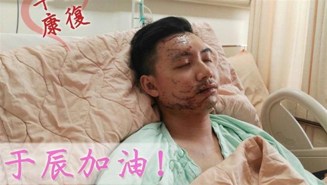 傷勢終趨穩　國道倖存警：會堅強面對
