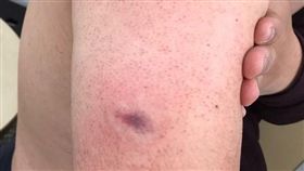 基隆，市警忠2路派出所邵姓員警處理男女金錢糾紛，竟被男方咬傷手臂。翻攝畫面